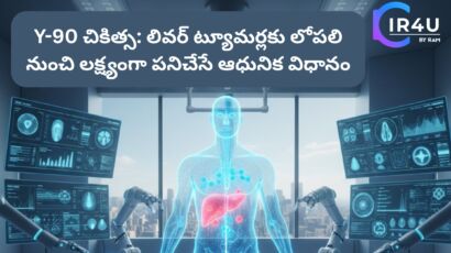 Y-90 చికిత్స