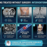 10 Conditions That Can Be Treated Without Surgery Using Interventional Radiology