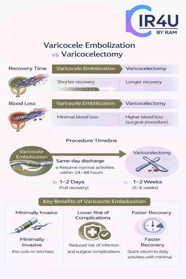 varicocele embolization compared varococeletomy
