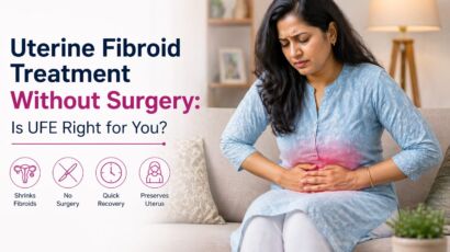 uterine fibroid treatment without surgery