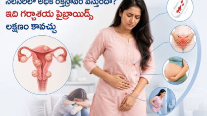 Common uterine fibroid symptoms.
