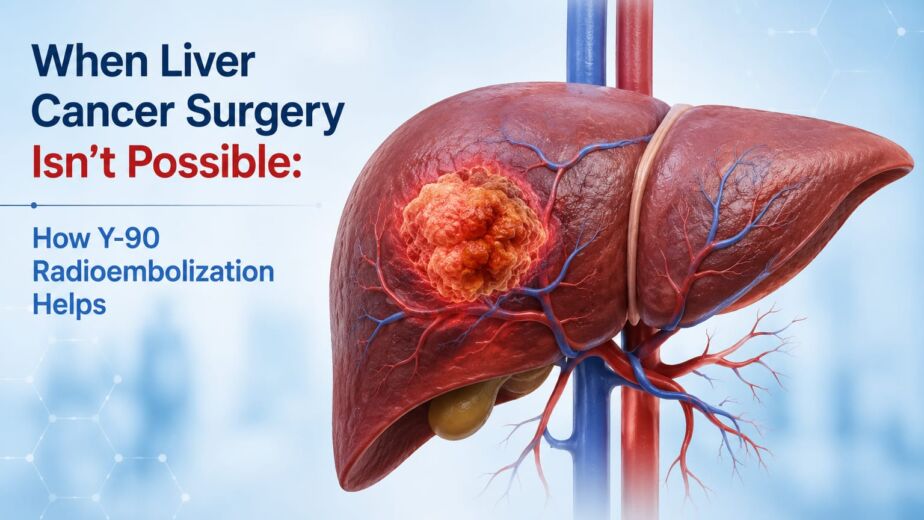 Y-90 radioembolization