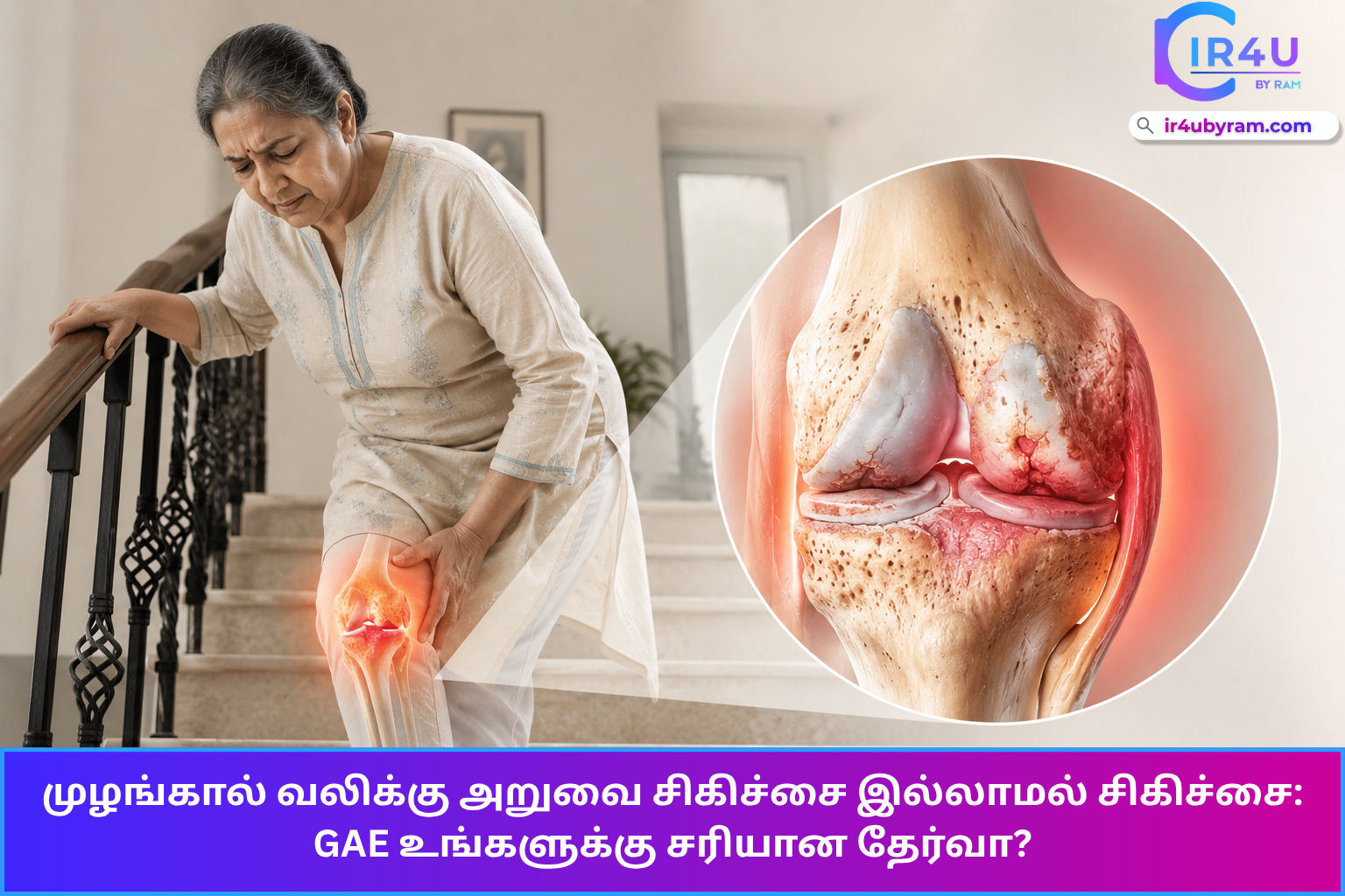 Knee pain treatment without surgery gae