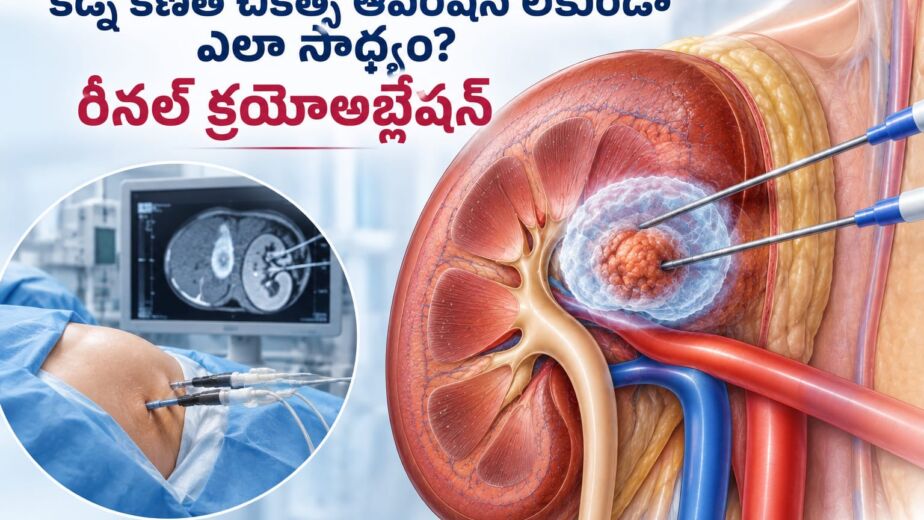 kidney tumor treatment